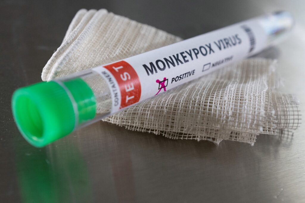 El virus de la viruela del mono podría transmitirse también por vía aérea