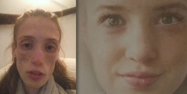 La anorexia contada en primera persona, en TVC