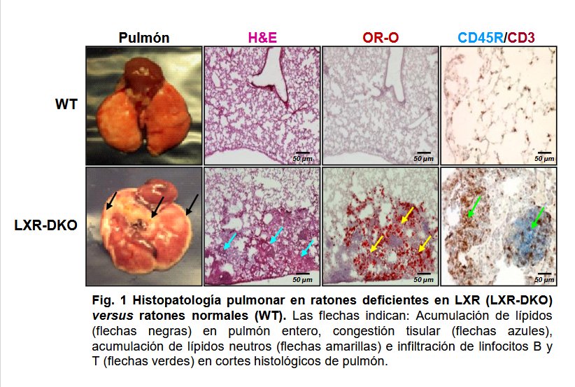 La ULPG investiga un tratamiento para las enfermedades pulmonares