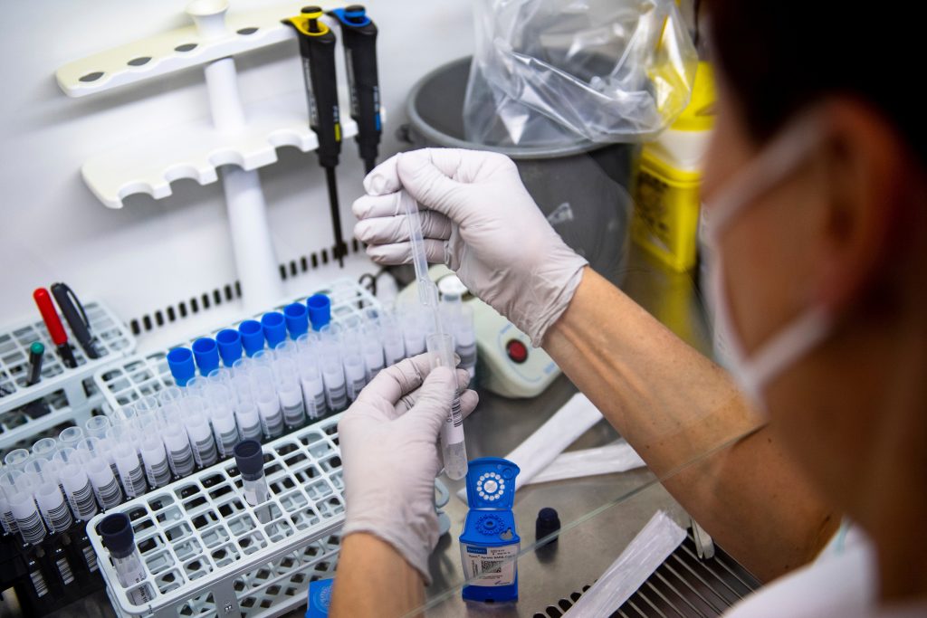Sanidad contabiliza dos casos confirmados de viruela del mono