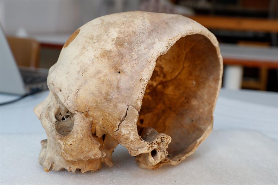 La revisión de los fondos del Museo Canario ha aportado una prueba directa de que las primeras sociedades que habitaron Canarias no estuvieron tan aisladas del exterior durante siglos como se pensaba: una herida de espada, un arma ajena por completo al mundo aborigen, que le seccionó la cabeza a un varón entre 200 y 300 años antes de la llegada de los europeos. La conservadora del Museo, Teresa Delgado, muestra el cráneo, datado entre los siglos XI y XII, con la herida de espada. EFE/Elvira Urquijo Á.