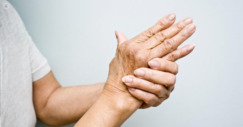 Imagen mano afectada por artrosis